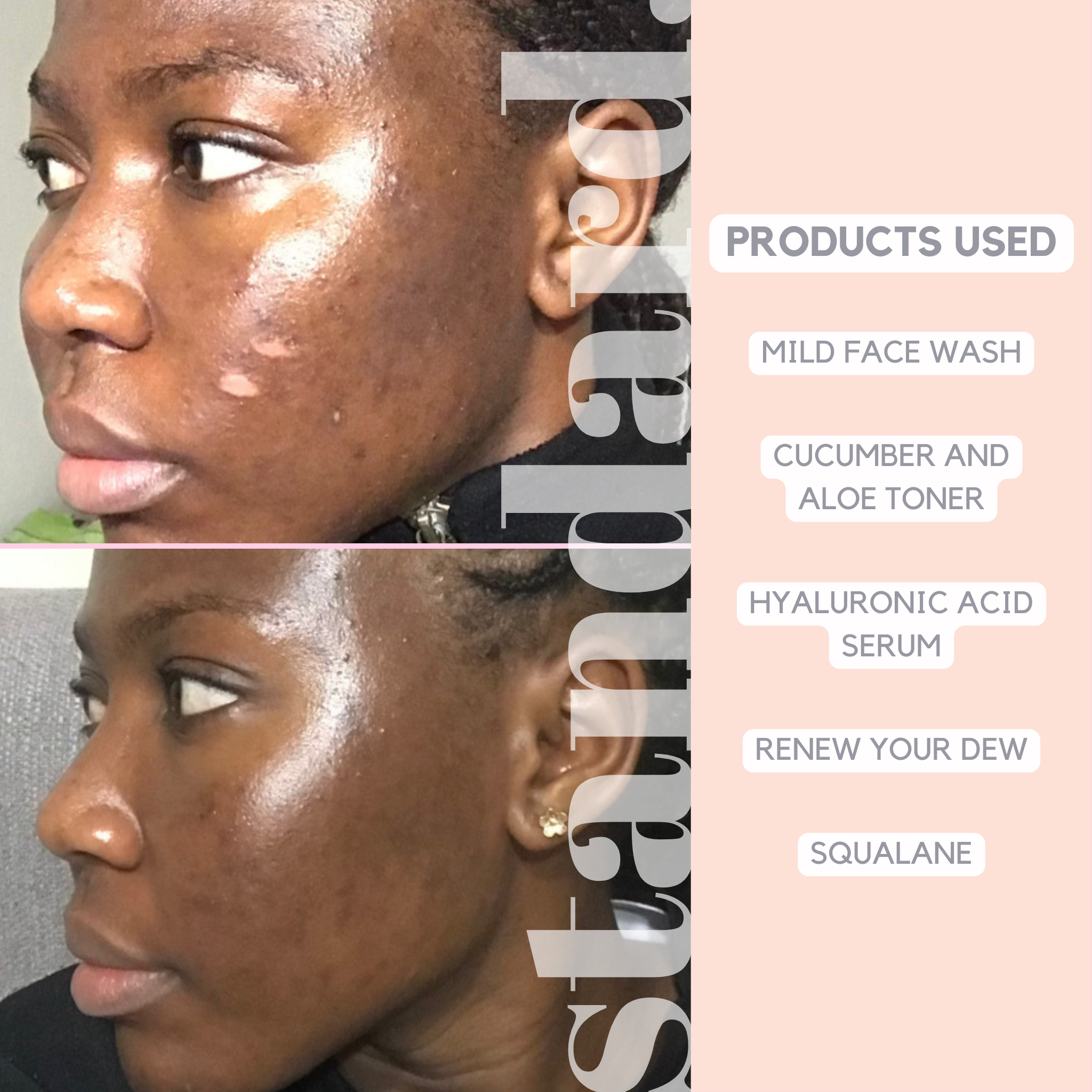 Hyaluronic Acid 1,5% & Peptides Serum - 30ml