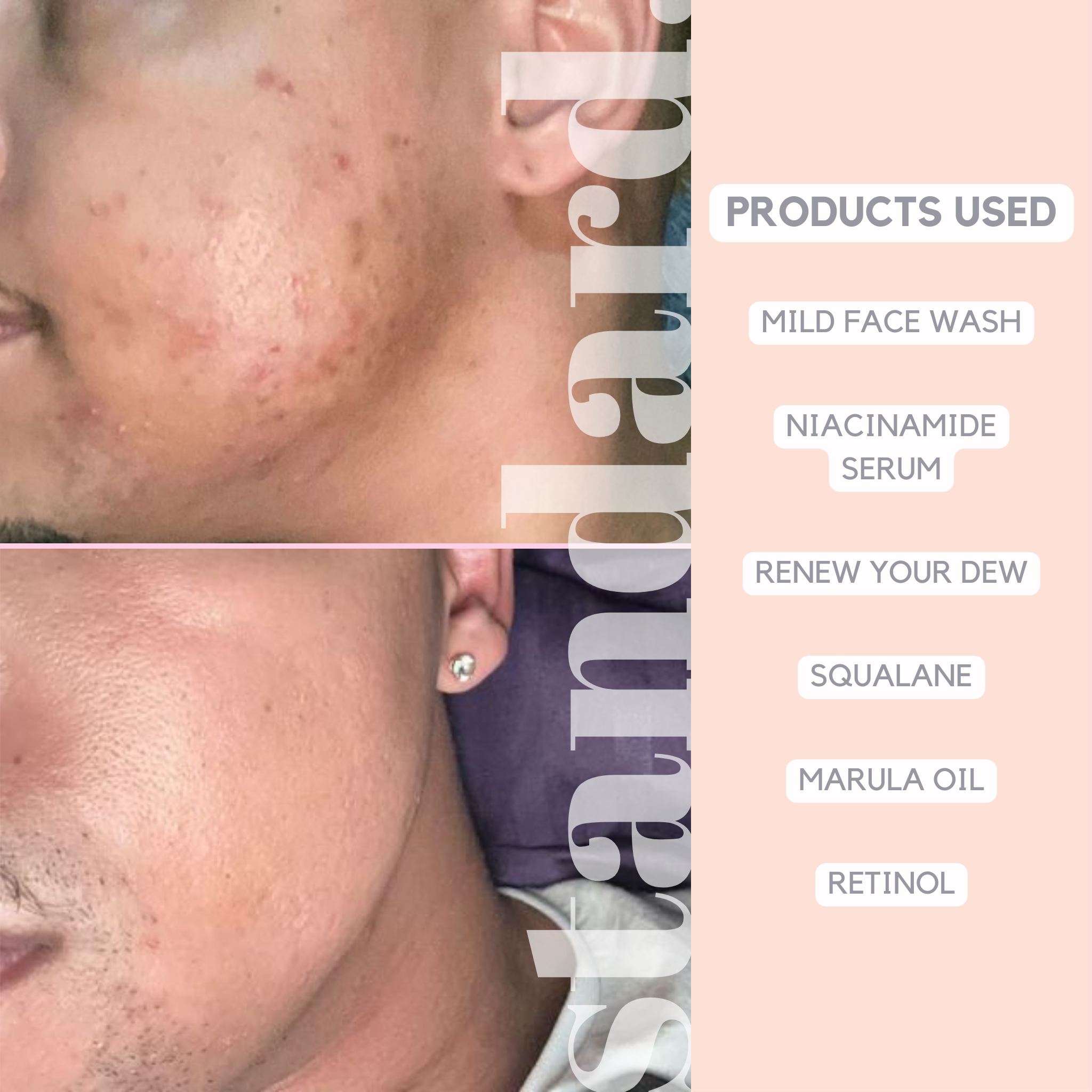 Retinol 0,3 (Vitamin A) % Serum with Niacinamide & Hyaluronic Acid - 30ml
