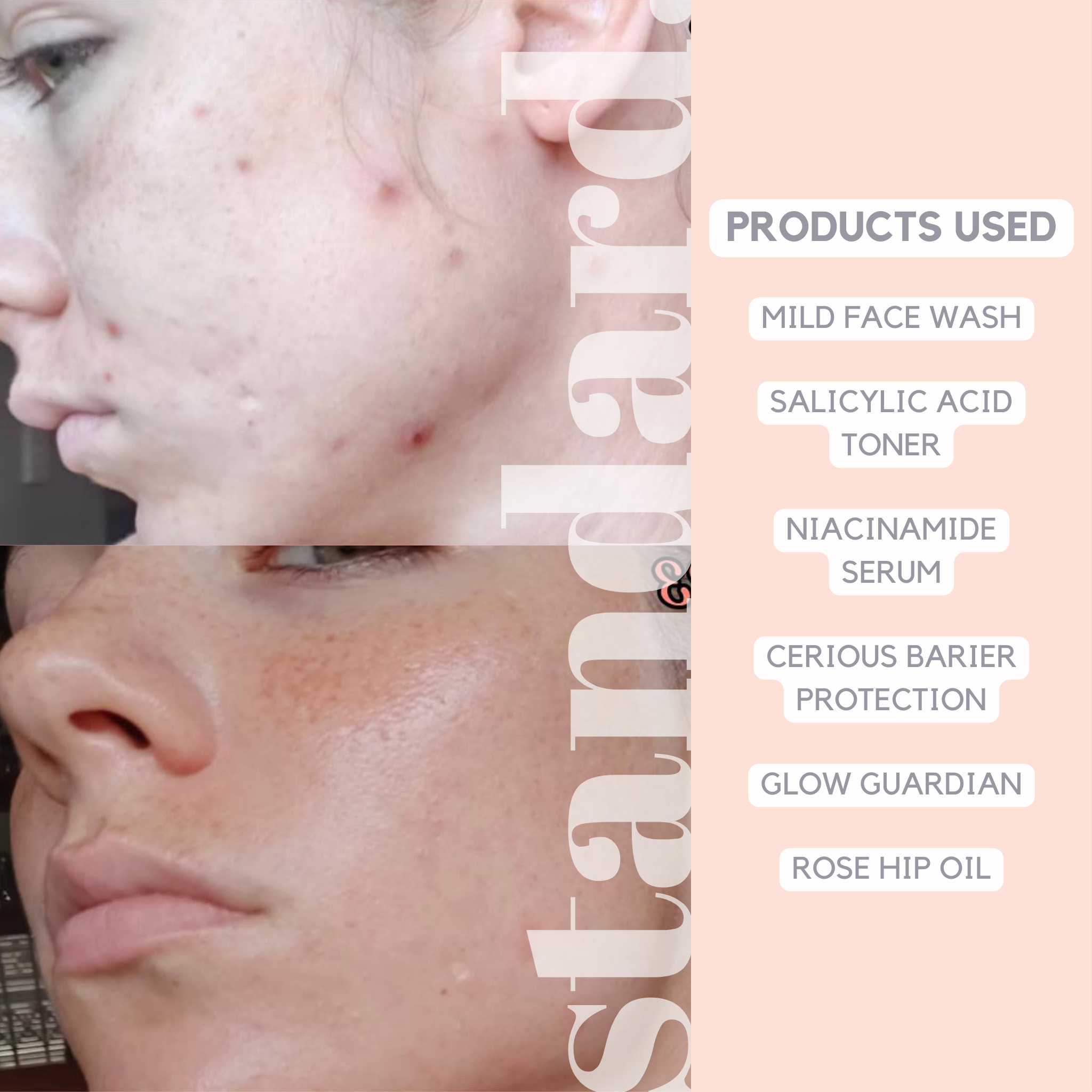 CERious PrOATection Moisturiser with 4% Ceramide & Oat Extract - 10ml