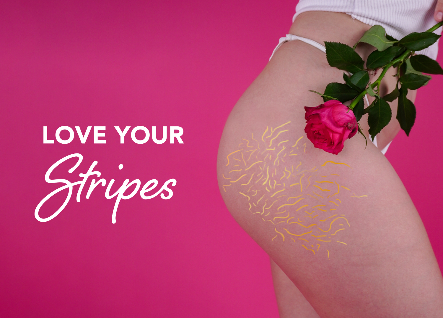 How To Love Your Stretch Marks. Love Your Skin. 